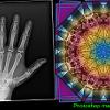Dicom X-ray and Photoshop